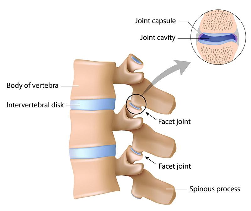 Facet Joint Injections in Wichita KS