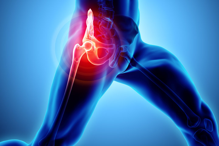 Hip Injections for Hip Pain in Wichita